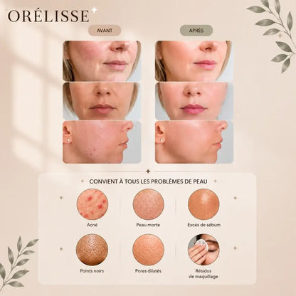 Brosse Orélisse | Nettoyage Profond & Anti-Imperfections